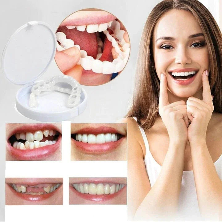 Snap on Smile Veneers (Upper & Lower)