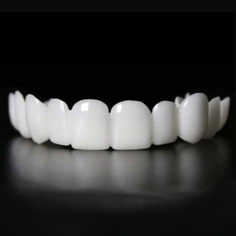 Snap on Smile Veneers (Upper & Lower)