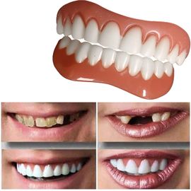 Snap-On Veneer Teeth